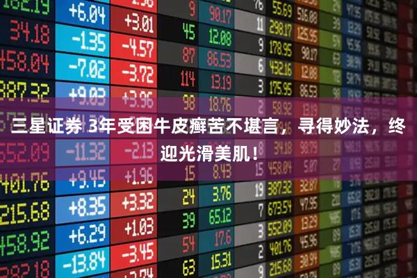 三星证券 3年受困牛皮癣苦不堪言，寻得妙法，终迎光滑美肌！